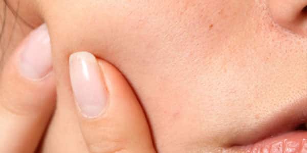 علاج الحبوب تحت الجلد في الوجه والجسم والمؤخرة والمناطق الحساسة